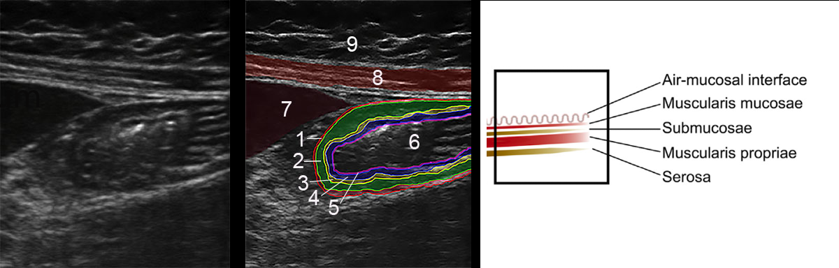 EEU case image missing